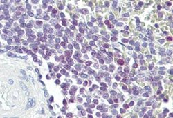 E74 like factor 1 Rabbit anti-Human, Polyclonal, Novus Biologicals 100
